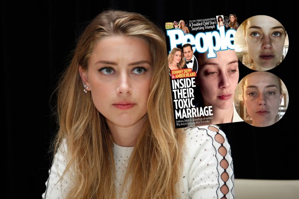 Amber Heard le visage tuméfié : De nouvelles photos dévoilées