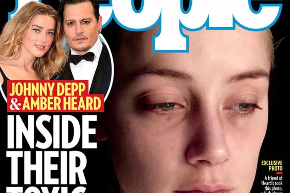 Amber Heard le visage tuméfié : De nouvelles photos dévoilées
