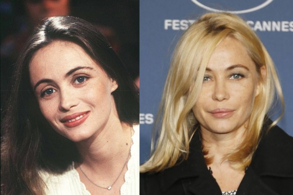 Courteney Cox, Kim Kardashian, Nicole Kidman : ces 12 stars accro à la chirurgie esthétique !