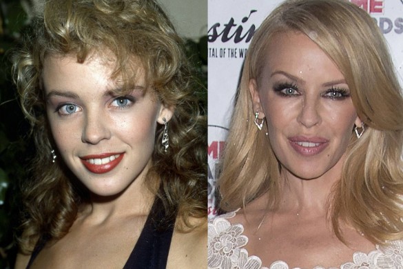 Courteney Cox, Kim Kardashian, Nicole Kidman : ces 12 stars accro à la chirurgie esthétique !